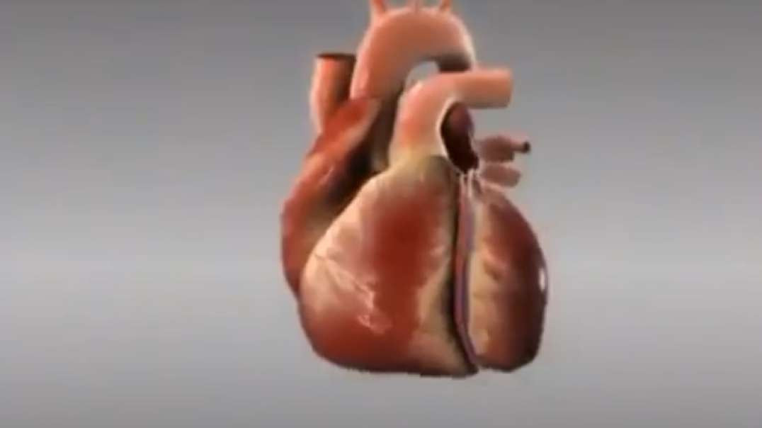 سکته قلبی چگونه اتفاق می افتد؟